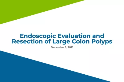 Endoscopic Evaluation and Resection of Large Colon Polyps